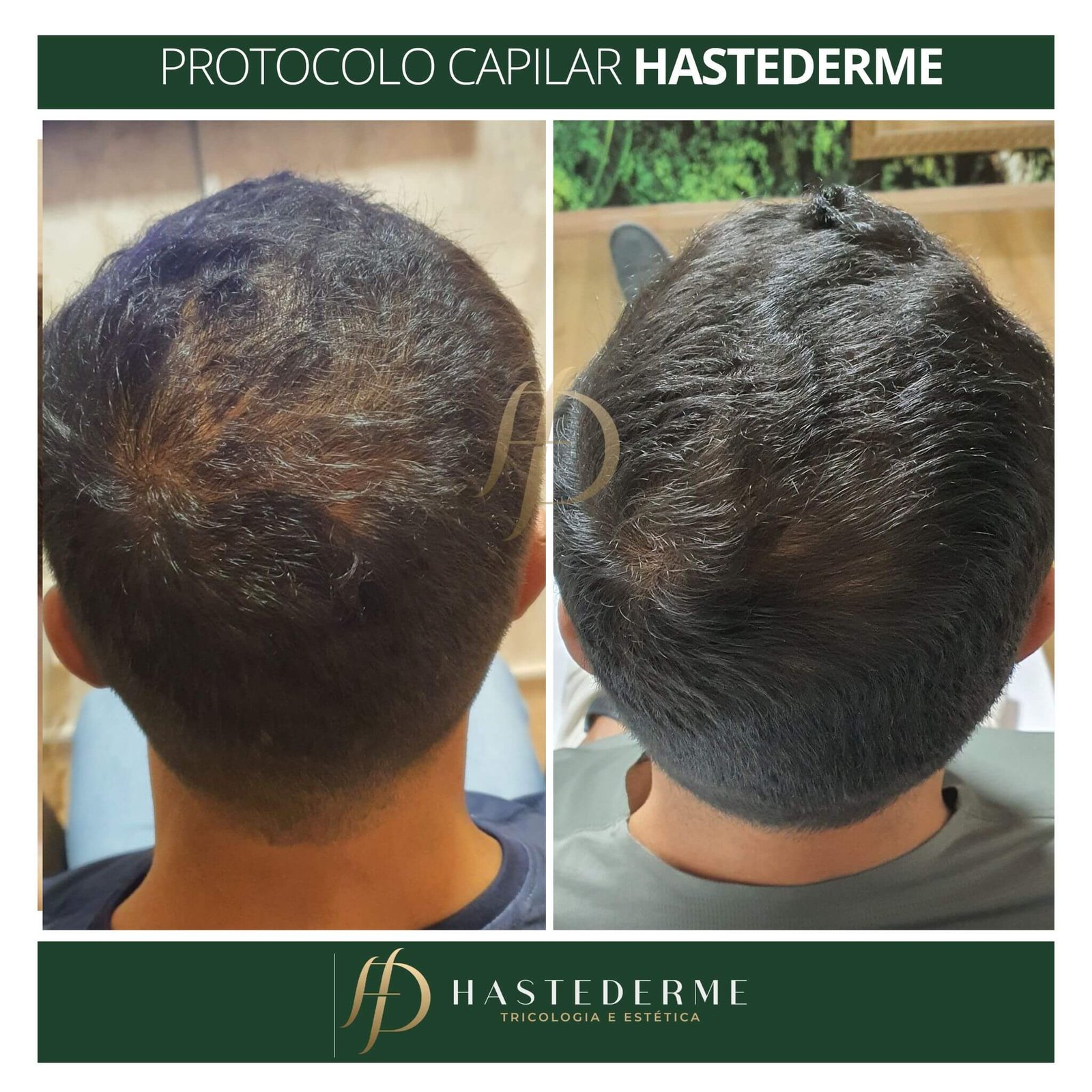 tratamento capilar