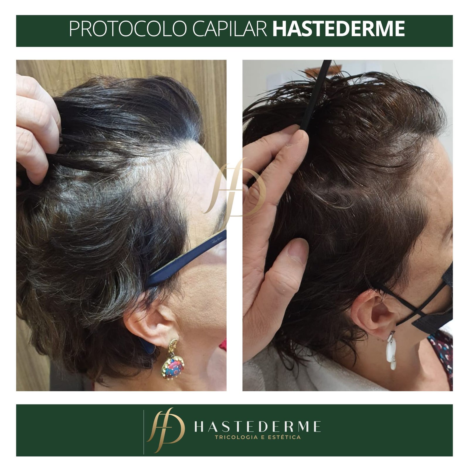 tratamento capilar antes e depois