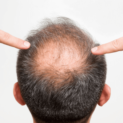 Sem nome (400 x 400 px) (1)