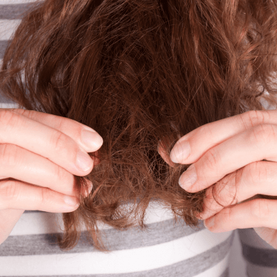 Cabelo quebradiço
