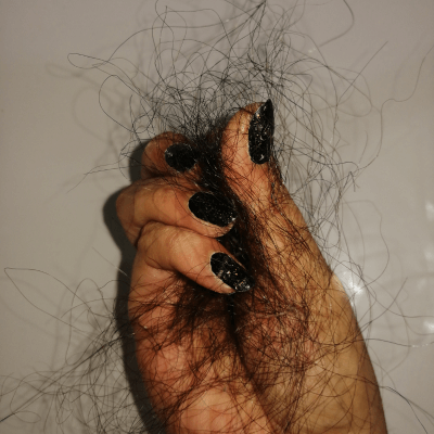 eflúvio telógeno - queda excessiva de cabelo