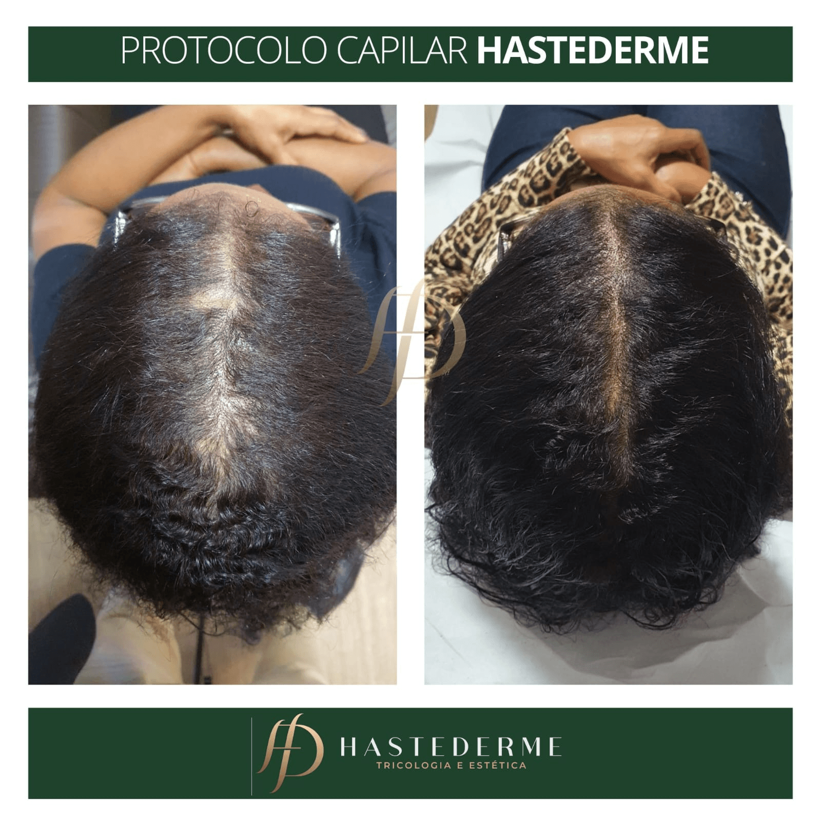 tratamento feminino